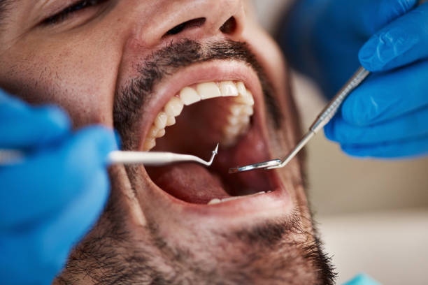 Best Dental Abscess Treatment in Lineville, AL